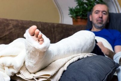 A man with a broken leg in plaster propped up.