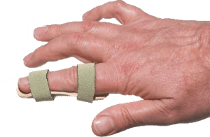 A hand with a finger wrapped in supports to illustrate an example of a finger injury claim.