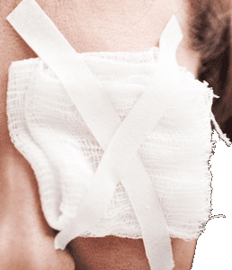 A patient with a bandage covering their eye following a surgical procedure