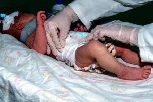 A baby being treated in hospital after a midwife gave negligent treatment 