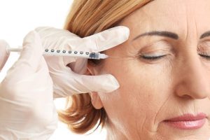 A woman has a dermal filler injection.