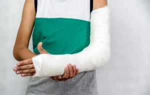 A woman with a bandaged arm due to injuries sustained from multiple animal bites.